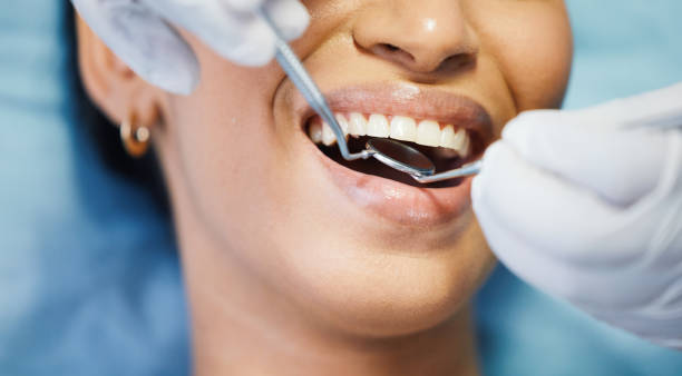 Best Emergency Gum Pain Relief  in Hallsville, TX