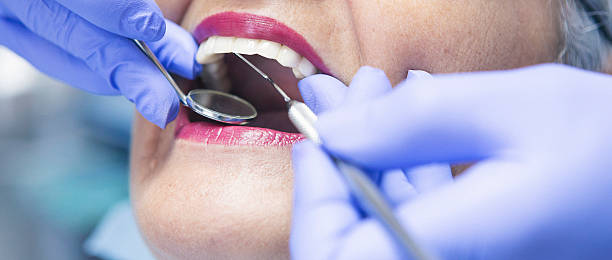 Best Dentist for Tooth Abscess  in Hallsville, TX