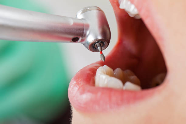 Best Walk-In Dentist Near Me  in Hallsville, TX